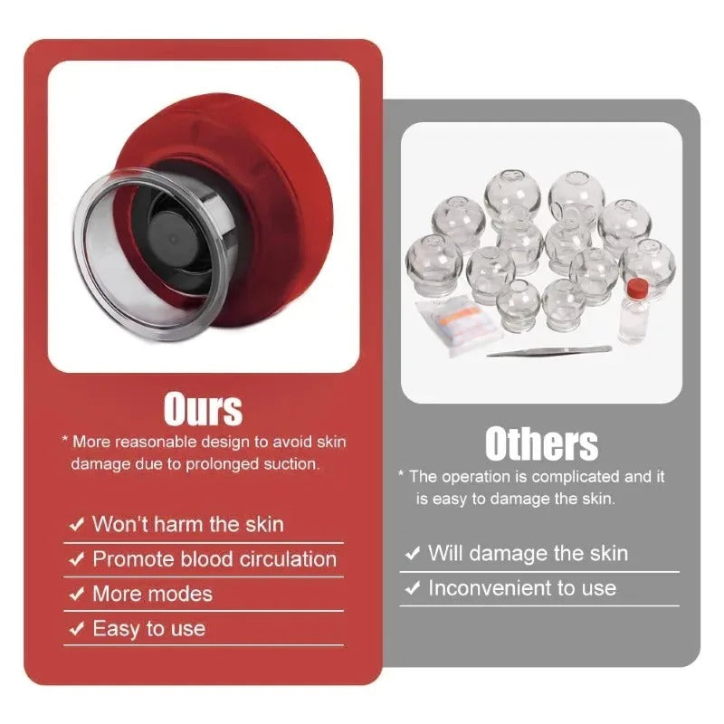 Electric Vacuum cupping therapy